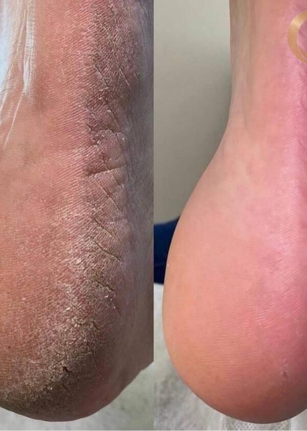 photo_168@01-07-2022_22-43-43